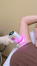 Depilacja laserowa - Arwit Beauty Salon Kosmetyczny - Kriolipoliza, Depilacja Laserowa, Oczyszczanie Wodorowe Dołuje