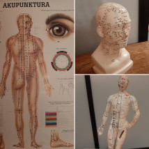 Akupunktura - Centrum Terapii Somatycznej i Pomocy Psychologicznej Kraków