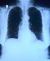 Zdjęcia RTG ogólnodiagnostyczne (płuc, stawów, kości) - PRACOWNIA RTG  DAGAMED  Oświęcim